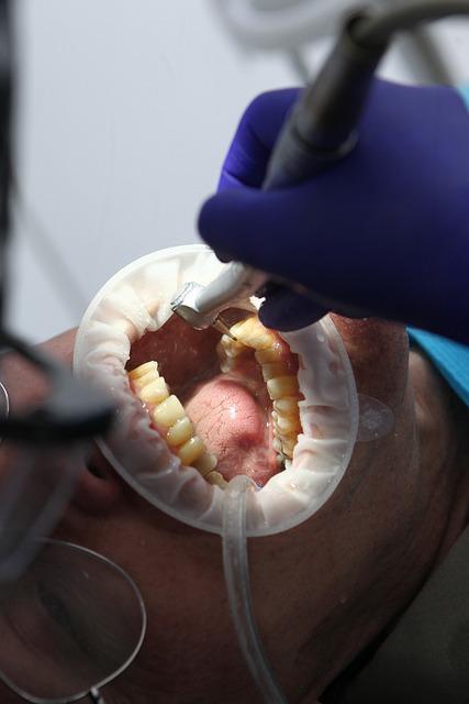 Nejnovější trendy v oblasti bělení zubů v Ostravě